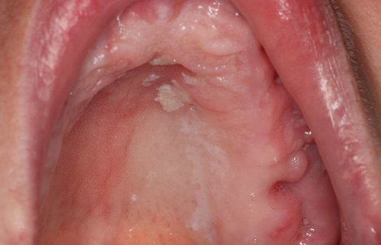 Oral case image (Photo credit Dr. Ashley Clark)