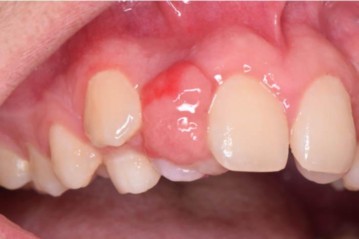 Oral case image (Photo credit Dr. Ashley Clark)