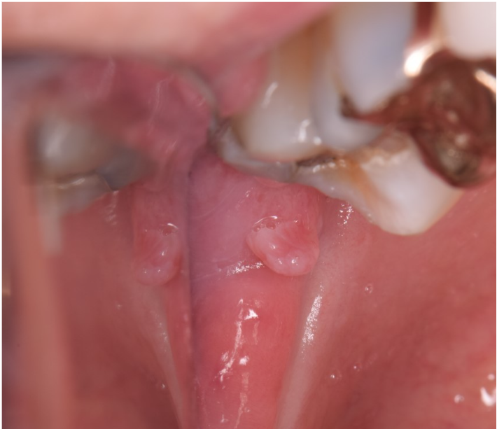 Oral case image (Photo credit Dr. Marcos Garcia)