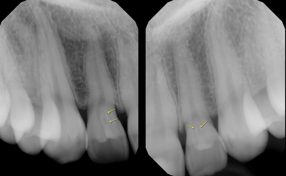 Radiology Case 2 Image 2